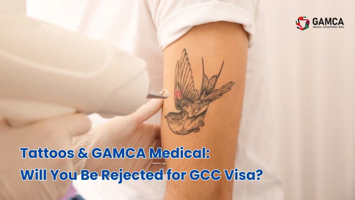 The impact of tattoos on GCC medical tests in India